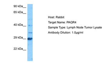PAQR4 Rabbit Polyclonal Antibody