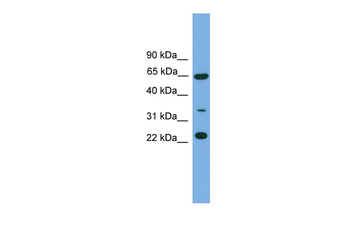 TRAPPC5 Rabbit Polyclonal Antibody