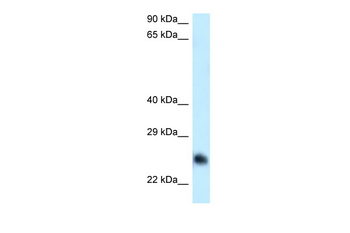 CABYR Rabbit Polyclonal Antibody