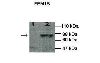 FEM1B Rabbit Polyclonal Antibody
