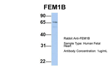 FEM1B Rabbit Polyclonal Antibody