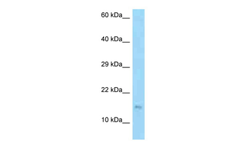 EDDM3B Rabbit Polyclonal Antibody