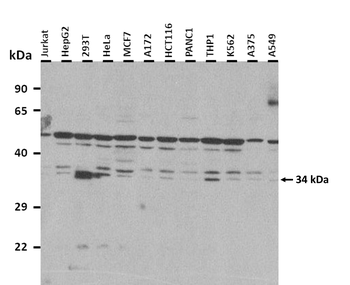 C17orf39 Rabbit Polyclonal Antibody