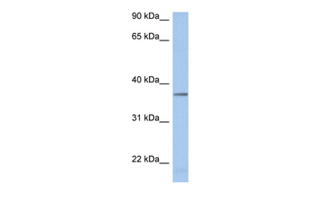 LDHAL6B Rabbit Polyclonal Antibody