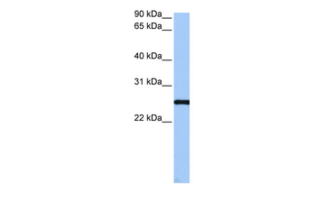 CCDC46 Rabbit Polyclonal Antibody