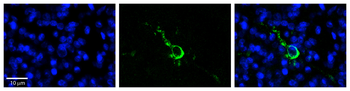 LPIN1 Rabbit Polyclonal Antibody