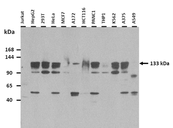 ERCC5 Rabbit Polyclonal Antibody