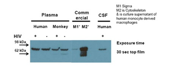 GSN Rabbit Polyclonal Antibody
