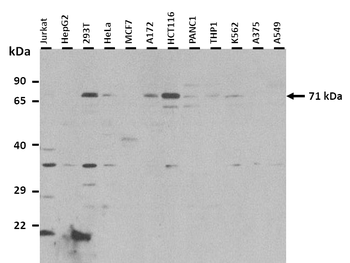 ALAS1 Rabbit Polyclonal Antibody