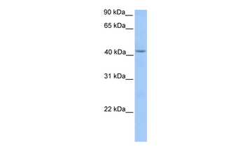 HMBS Rabbit Polyclonal Antibody