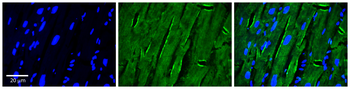 SH3KBP1 Rabbit Polyclonal Antibody