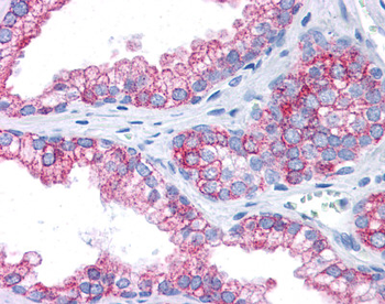 EPB41L2 Rabbit Polyclonal Antibody