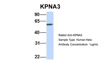 KPNA3 Rabbit Polyclonal Antibody