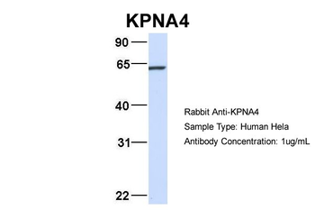 KPNA4 Rabbit Polyclonal Antibody