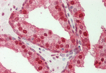 GBP2 Rabbit Polyclonal Antibody