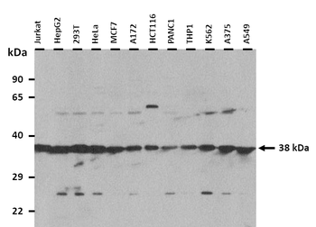 CDC42EP4 Rabbit Polyclonal Antibody
