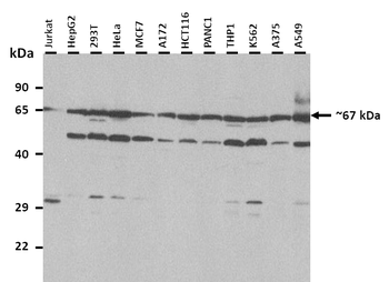 LMOD1 Rabbit Polyclonal Antibody