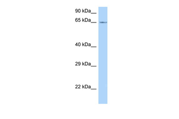Lmod1 Rabbit Polyclonal Antibody