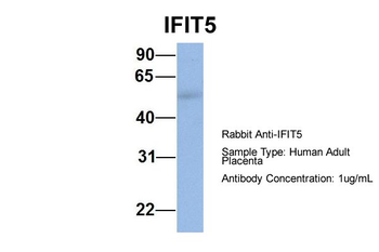 IFIT5 Rabbit Polyclonal Antibody