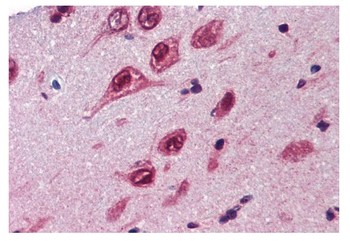 UBQLN1 Rabbit Polyclonal Antibody