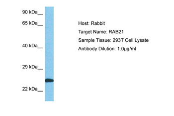 RAB21 Rabbit Polyclonal Antibody