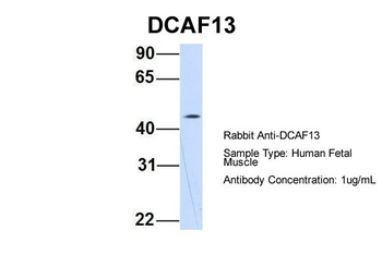 WDSOF1 Rabbit Polyclonal Antibody
