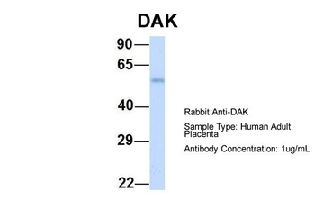 TKFC Rabbit Polyclonal Antibody