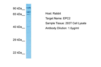 EPC2 Rabbit Polyclonal Antibody