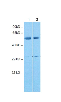 ARRDC4 Rabbit Polyclonal Antibody