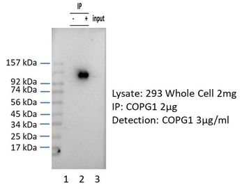 COPG Rabbit Polyclonal Antibody