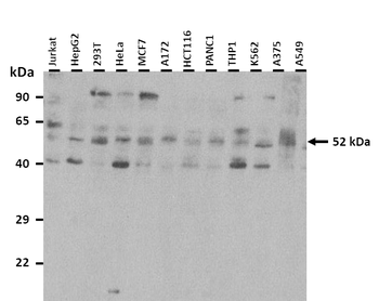 MKNK2 Rabbit Polyclonal Antibody