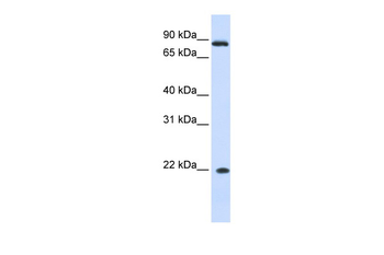IFNA7 Rabbit Polyclonal Antibody