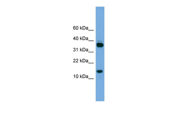 PRR15 Rabbit Polyclonal Antibody