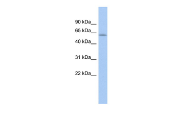 LEMD2 Rabbit Polyclonal Antibody