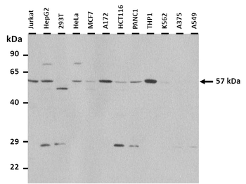 LEMD2 Rabbit Polyclonal Antibody