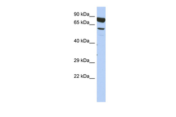 DPY19L4 Rabbit Polyclonal Antibody