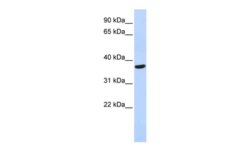 SPDYA Rabbit Polyclonal Antibody