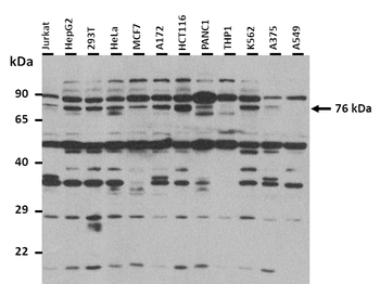LRRC33 Rabbit Polyclonal Antibody