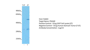 PRAME Rabbit Polyclonal Antibody