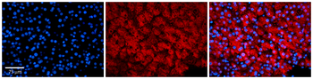 MVK Rabbit Polyclonal Antibody