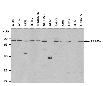 ALDH18A1 Rabbit Polyclonal Antibody