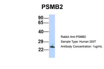 PSMB2 Rabbit Polyclonal Antibody