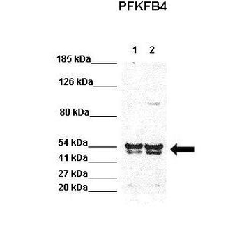 PFKFB4 Rabbit Polyclonal Antibody