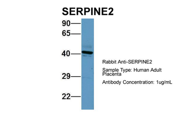 SERPINE2 Rabbit Polyclonal Antibody