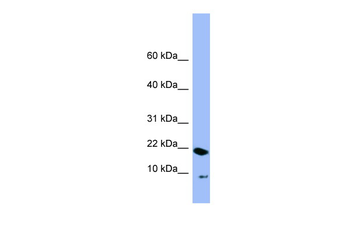 PIN4 Rabbit Polyclonal Antibody