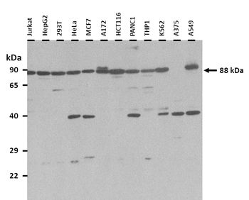 PNPLA8 Rabbit Polyclonal Antibody