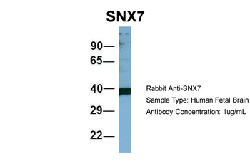 SNX7 Rabbit Polyclonal Antibody