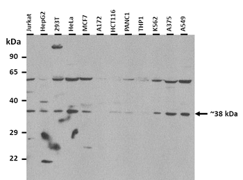 UCHL5 Rabbit Polyclonal Antibody