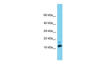 Med31 Rabbit Polyclonal Antibody