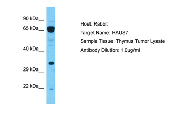 HAUS7 Rabbit Polyclonal Antibody